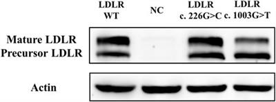 Two Novel Disease-Causing Mutations in the LDLR of Familial Hypercholesterolemia